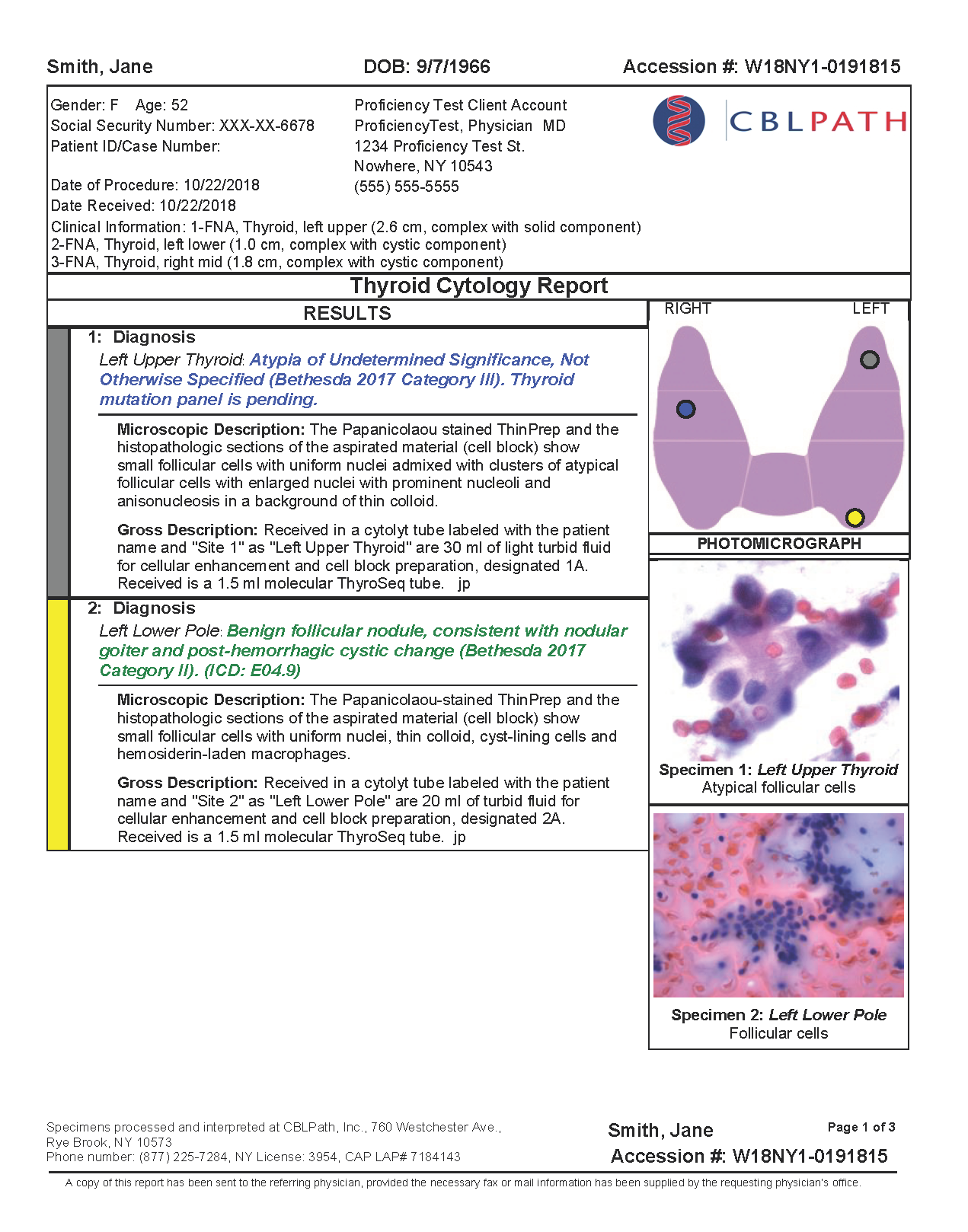 Thyroid Cytology Report