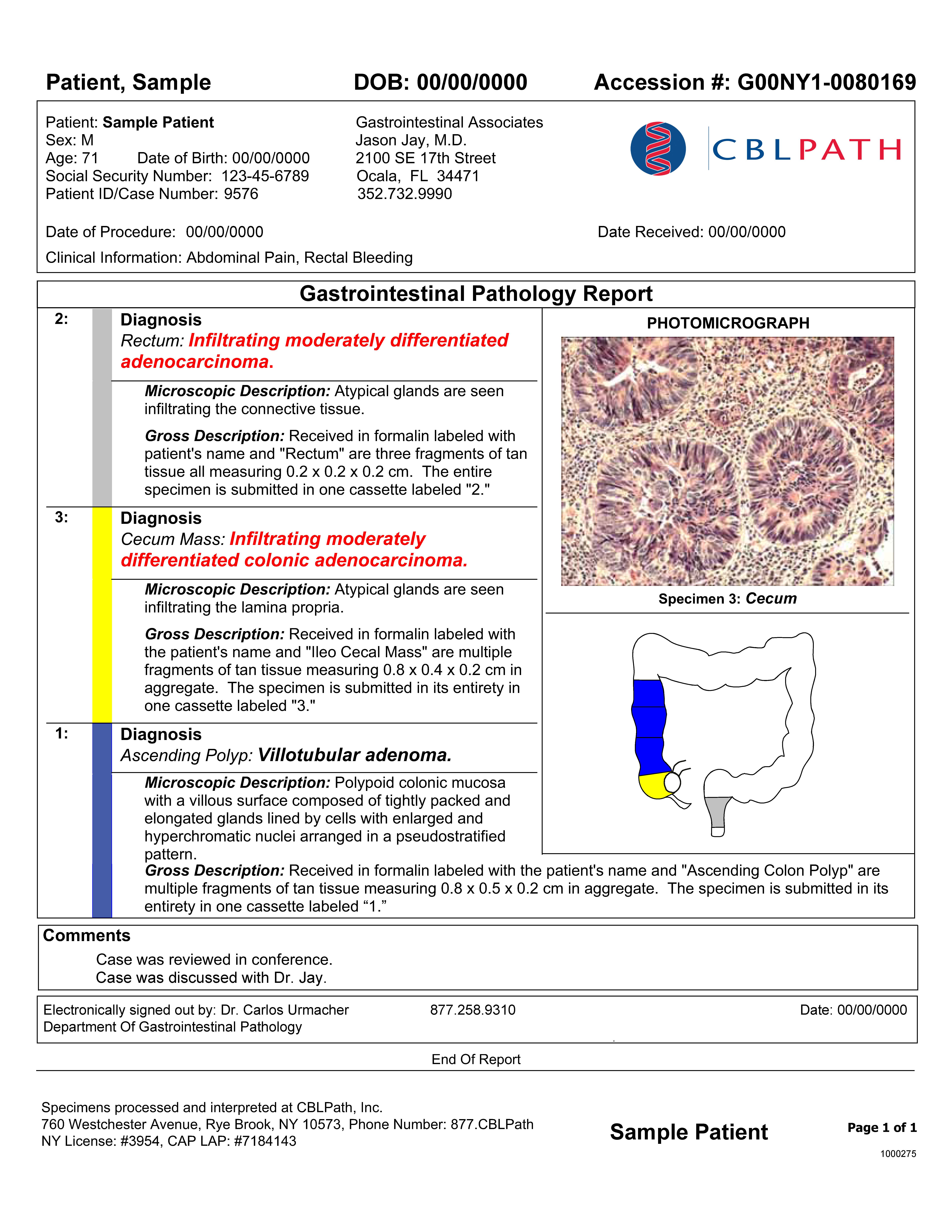 GI Pathology Report